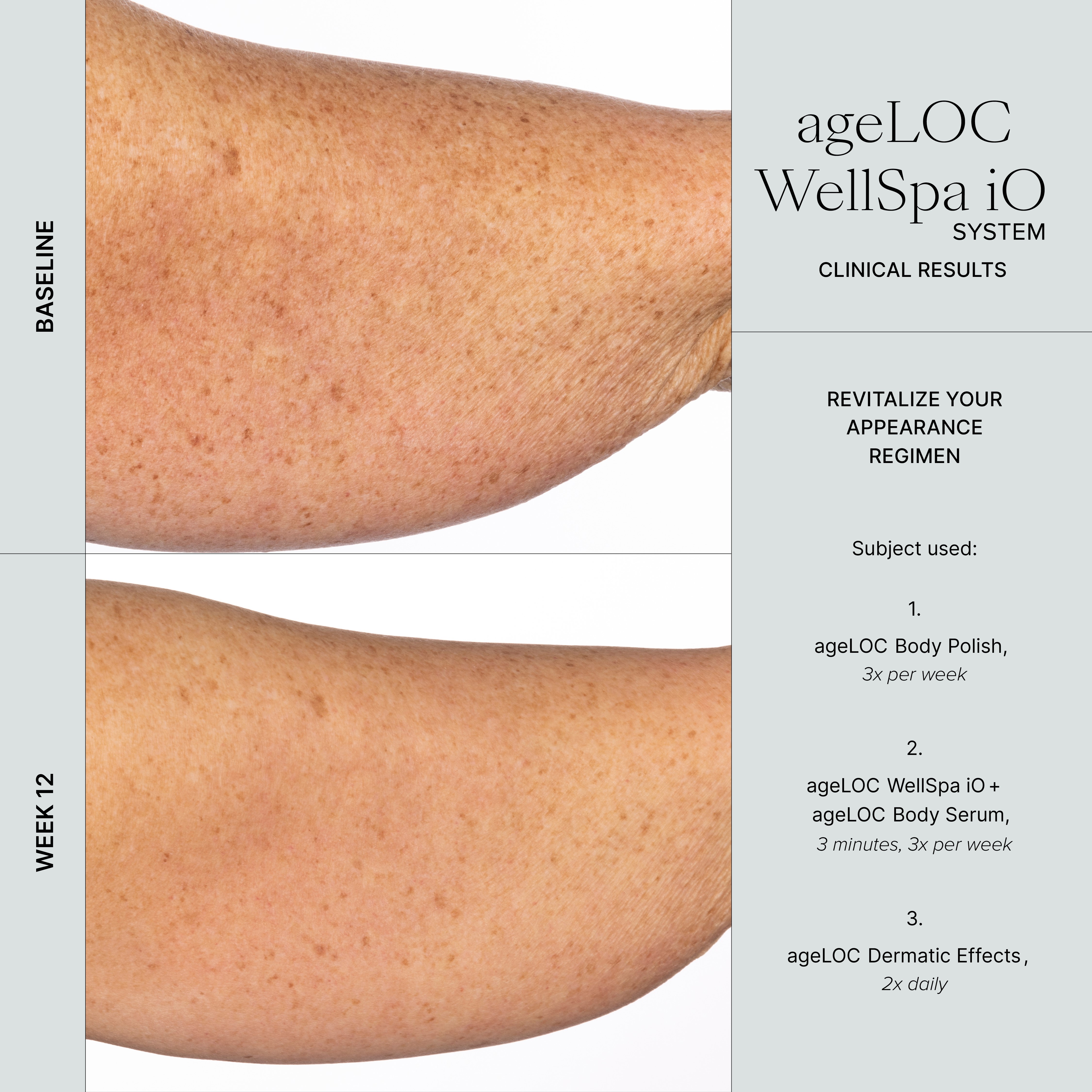 WellSpa iO before after 3min 3x arm 2